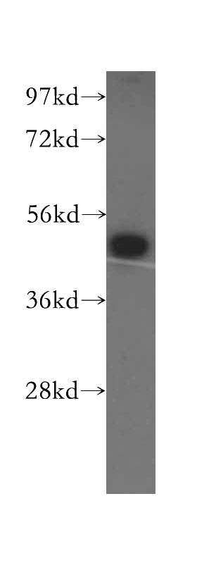 HeLa cells were subjected to SDS PAGE followed by western blot with Catalog No:108539(BTD antibody) at dilution of 1:500