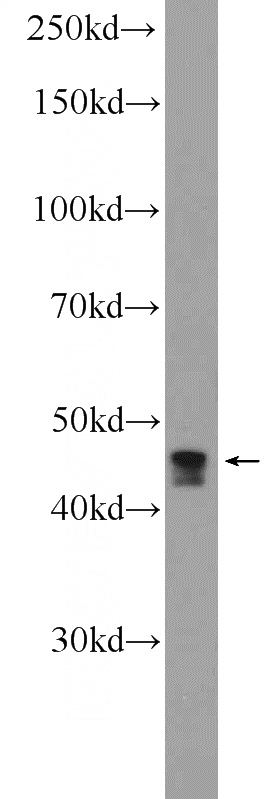 Jurkat cells were subjected to SDS PAGE followed by western blot with Catalog No:108989(CCDC83 Antibody) at dilution of 1:600