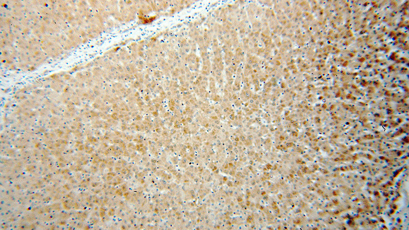 Immunohistochemical of paraffin-embedded human liver using Catalog No:113335(OGG1 antibody) at dilution of 1:100 (under 10x lens)