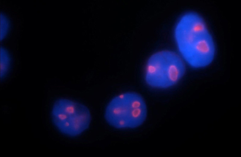 Immunofluorescent analysis of HepG2 cells, using DDX21 antibody Catalog No:109821 at 1:50 dilution and Rhodamine-labeled goat anti-rabbit IgG (red). Blue pseudocolor = DAPI (fluorescent DNA dye).