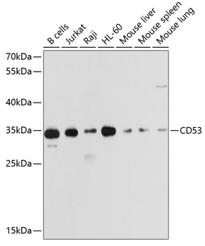 Western blot - CD53 Polyclonal Antibody 