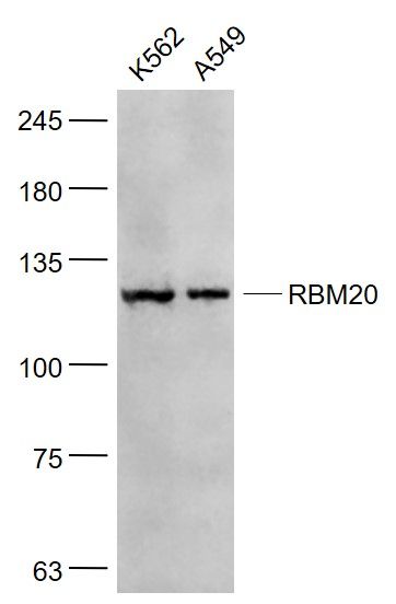 Fig2: Sample:; K562(Human) Cell Lysate at 30 ug; A549(Human) Cell Lysate at 30 ug; Primary: Anti- RBM20 at 1/1000 dilution; Secondary: IRDye800CW Goat Anti-Rabbit IgG at 1/20000 dilution; Predicted band size: 134 kD; Observed band size: 130 kD