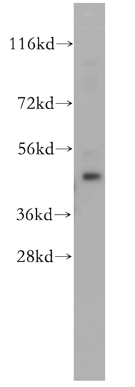 mouse testis tissue were subjected to SDS PAGE followed by western blot with Catalog No:110150(DYX1C1 antibody) at dilution of 1:1000