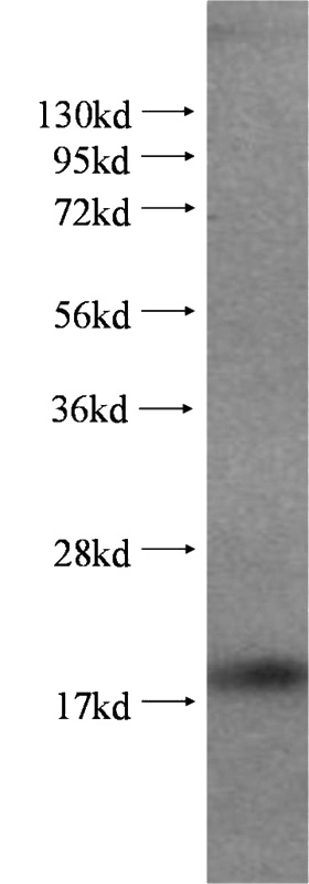 Jurkat cells were subjected to SDS PAGE followed by western blot with Catalog No:109672(PPIA antibody) at dilution of 1:500