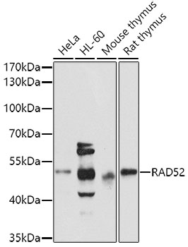 Western blot - RAD52 Polyclonal Antibody 