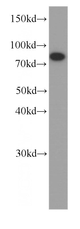 A375 cells were subjected to SDS PAGE followed by western blot with Catalog No:107311(HADHA antibody) at dilution of 1:1000