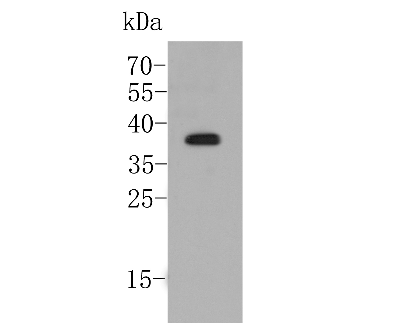 Fig1:; Western blot analysis of D14 on rice tissue lysate. Proteins were transferred to a PVDF membrane and blocked with 5% BSA in PBS for 1 hour at room temperature. The primary antibody ( 1/500) was used in 5% BSA at room temperature for 2 hours. Goat Anti-Rabbit IgG - HRP Secondary Antibody (HA1001) at 1:5,000 dilution was used for 1 hour at room temperature.