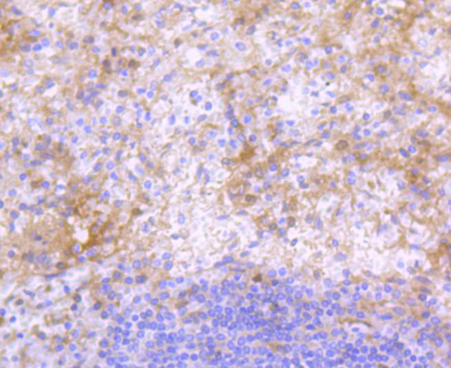 Fig3:; Immunohistochemical analysis of paraffin-embedded human spleen tissue using anti-IgG4 antibody. The section was pre-treated using heat mediated antigen retrieval with Tris-EDTA buffer (pH 8.0-8.4) for 20 minutes.The tissues were blocked in 5% BSA for 30 minutes at room temperature, washed with ddH; 2; O and PBS, and then probed with the primary antibody ( 1/50) for 30 minutes at room temperature. The detection was performed using an HRP conjugated compact polymer system. DAB was used as the chromogen. Tissues were counterstained with hematoxylin and mounted with DPX.
