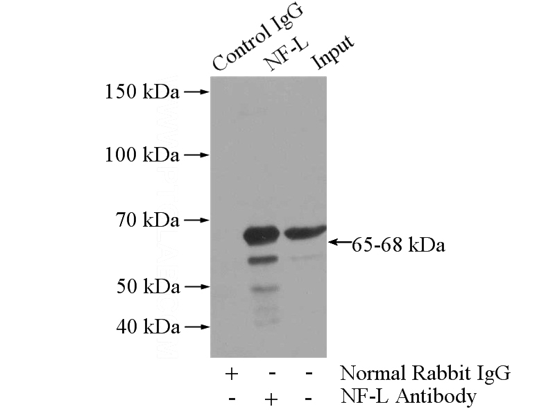 NF-L antibody