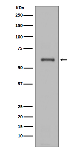 HeLa cells were subjected to SDS PAGE followed by western blot with Catalog No:113314(NOX4 antibody) at dilution of 1:600