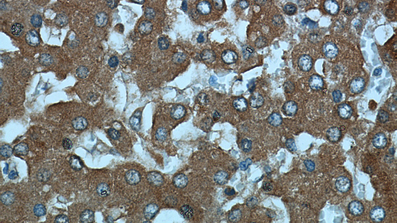 Immunohistochemical of paraffin-embedded human liver using Catalog No:115331(SLC25A25 antibody) at dilution of 1:50 (under 40x lens)