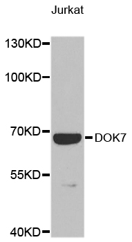 Western blot - DOK7 Polyclonal Antibody 