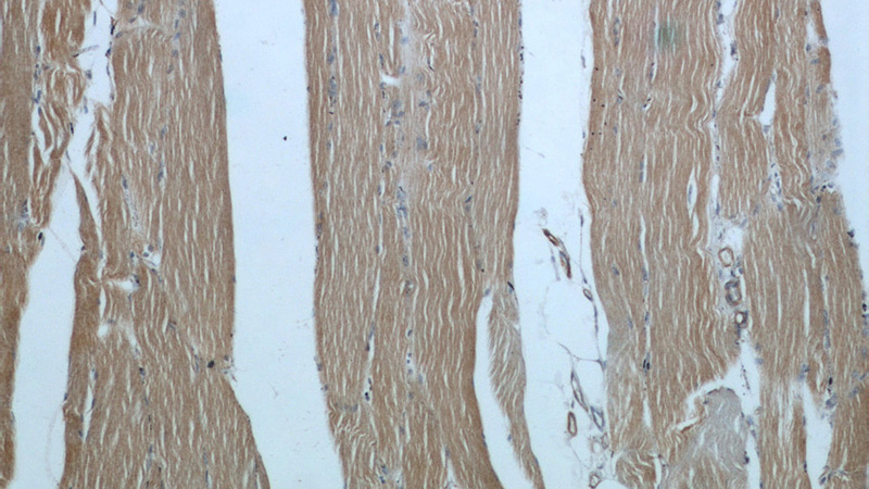 Immunohistochemical of paraffin-embedded human skeletal muscle using Catalog No:117305(ACTB antibody) at dilution of 1:100 (under 10x lens)