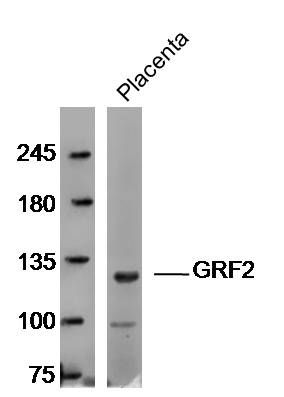 Fig1: Sample: Placenta (Mouse) Lysate at 40 ug; Primary: Anti-GRF2 at 1/300 dilution; Secondary: IRDye800CW Goat Anti-Rabbit IgG at 1/20000 dilution; Predicted band size: 140 kD; Observed band size: 120 kD