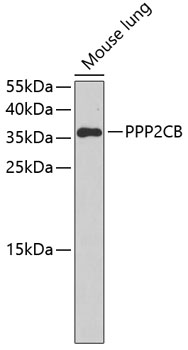 Western blot - PPP2CB Polyclonal Antibody 
