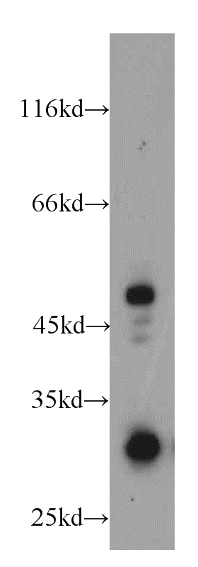 RAW264.7 cells were subjected to SDS PAGE followed by western blot with Catalog No:111728(HUS1B antibody) at dilution of 1:500