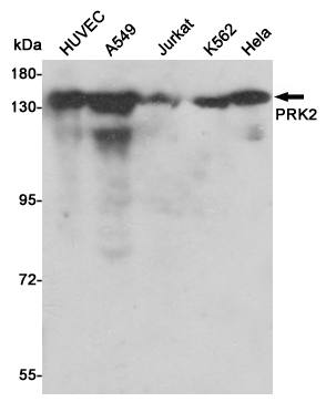 Western blot detection of PRK2 in HUVEC,A549,Jurkat,K562 and Hela cell lysates using PRK2 mouse mAb (1:500 diluted).Predicted band size:140KDa.Observed band size:140KDa.