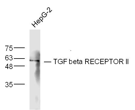 Fig3: Sample: HepG2 Cell Lysate at 40 ug; Primary: Anti- TGF beta RECEPTOR Ⅱ at 1/300 dilution; Secondary: IRDye800CW Goat Anti-Rabbit IgG at 1/20000 dilution; Predicted band size: 62 kD; Observed band size: 62 kD