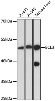 Western blot - BCL3 Polyclonal Antibody 