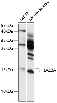 Western blot - LALBA Polyclonal Antibody 
