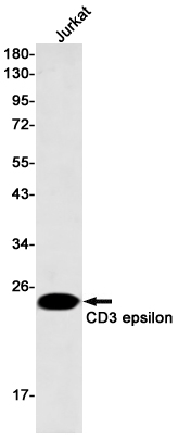 Western blot detection of CD3 epsilon in Jurkat cell lysates using CD3 epsilon Rabbit mAb(1:500 diluted).Predicted band size:23kDa.Observed band size:23kDa.
