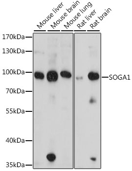 Western blot - SOGA1 Polyclonal Antibody 
