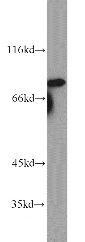 A431 cells were subjected to SDS PAGE followed by western blot with Catalog No:112802(MRE11A antibody) at dilution of 1:600