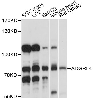 Western blot - ADGRL4 Polyclonal Antibody 