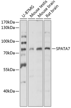 Western blot - SPATA7 Polyclonal Antibody 