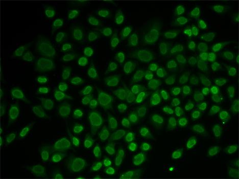Immunofluorescence - RAD54L2 Polyclonal Antibody 