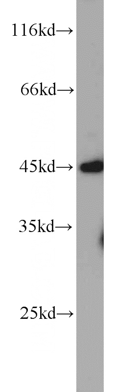 HeLa cells were subjected to SDS PAGE followed by western blot with Catalog No:107767(ADAM5P antibody) at dilution of 1:1000