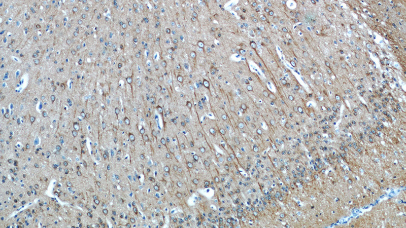 Immunohistochemistry of paraffin-embedded mouse brain tissue slide using Catalog No:117306(Tubulin-beta Antibody) at dilution of 1:50 (under 10x lens)