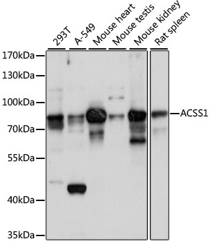 Western blot - ACSS1 Polyclonal Antibody 
