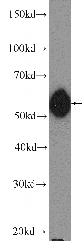Jurkat cells were subjected to SDS PAGE followed by western blot with Catalog No:113974(PNKP Antibody) at dilution of 1:1000