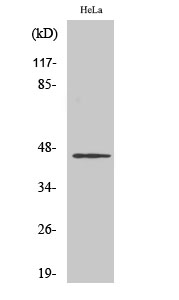 Fig1:; Western Blot analysis of various cells using HORMAD1 Polyclonal Antibody cells nucleus extracted by Minute TM Cytoplasmic and Nuclear Fractionation kit (SC-003,Inventbiotech,MN,USA).
