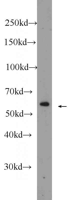 PC-13 cells were subjected to SDS PAGE followed by western blot with Catalog No:108783(C6orf204 Antibody) at dilution of 1:600