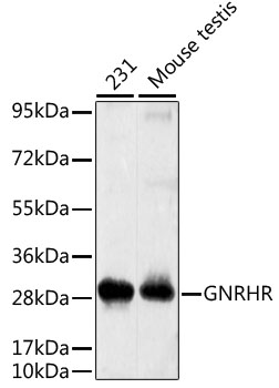 Western blot - GNRHR Polyclonal Antibody 