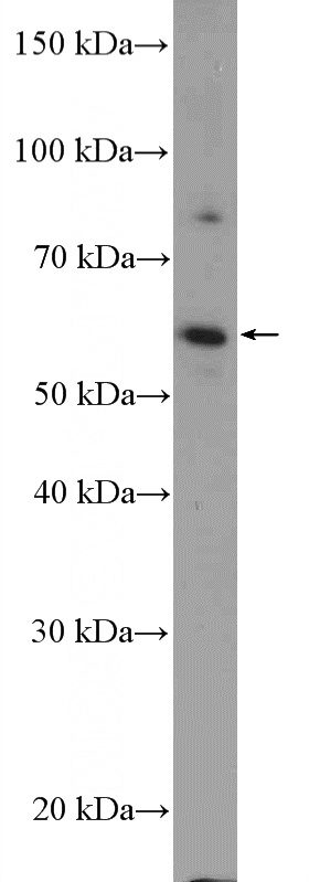 mouse testis tissue were subjected to SDS PAGE followed by western blot with Catalog No:111986(KIAA0895 Antibody) at dilution of 1:300