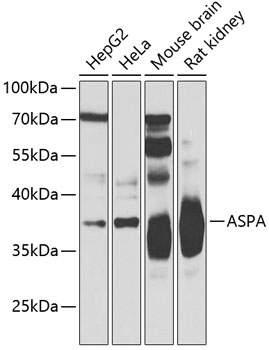 Western blot - ASPA Polyclonal Antibody 