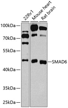 Western blot - SMAD6 Polyclonal Antibody 