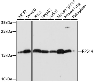 Western blot - RPS14 Polyclonal Antibody 