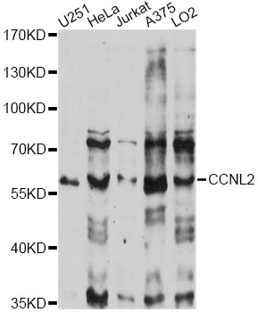 Western blot - CCNL2 Polyclonal Antibody 