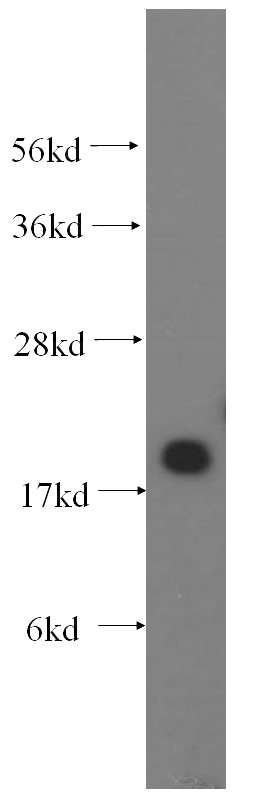 human liver tissue were subjected to SDS PAGE followed by western blot with Catalog No:109366(CFL2 antibody) at dilution of 1:400