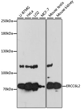 Western blot - ERCC6L2 Polyclonal Antibody 