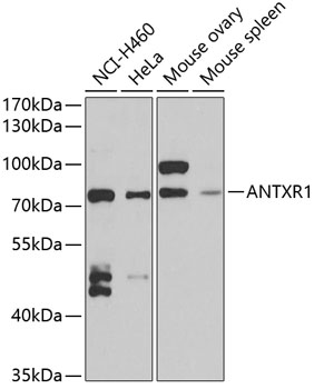 Western blot - ANTXR1 Polyclonal Antibody 