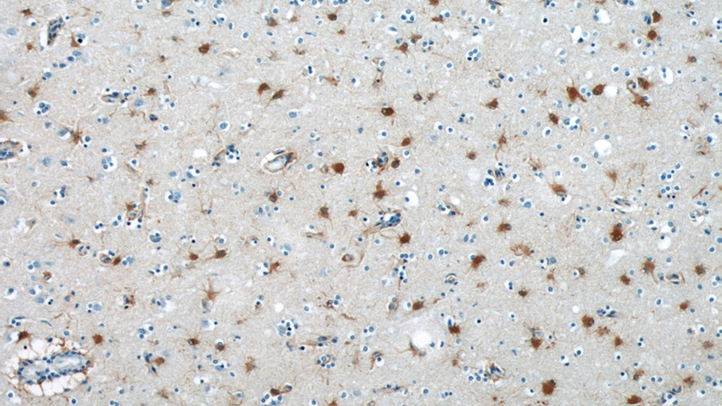 Immunohistochemical of paraffin-embedded human brain using Catalog No:114178(PRDX6 antibody) at dilution of 1:50 (under 10x lens)
