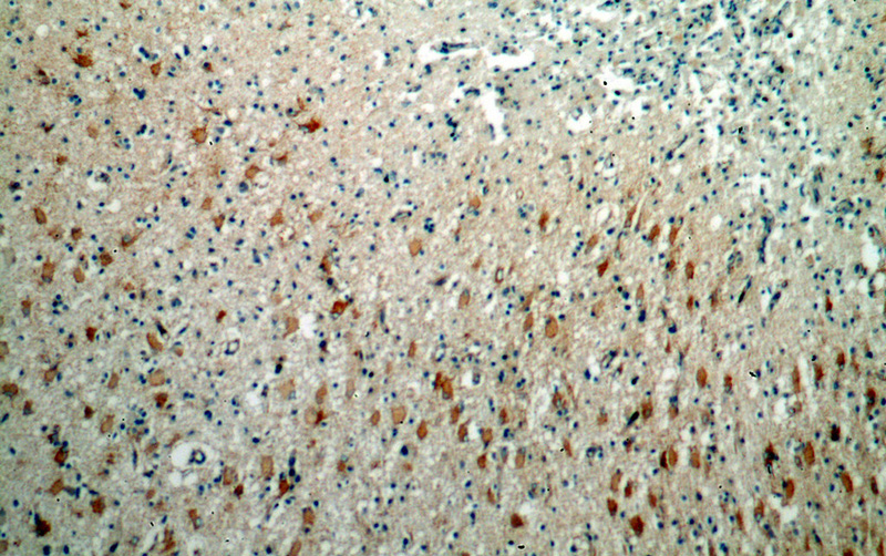 Immunohistochemical of paraffin-embedded human brain using Catalog No:113371(NUMB antibody) at dilution of 1:100 (under 10x lens)
