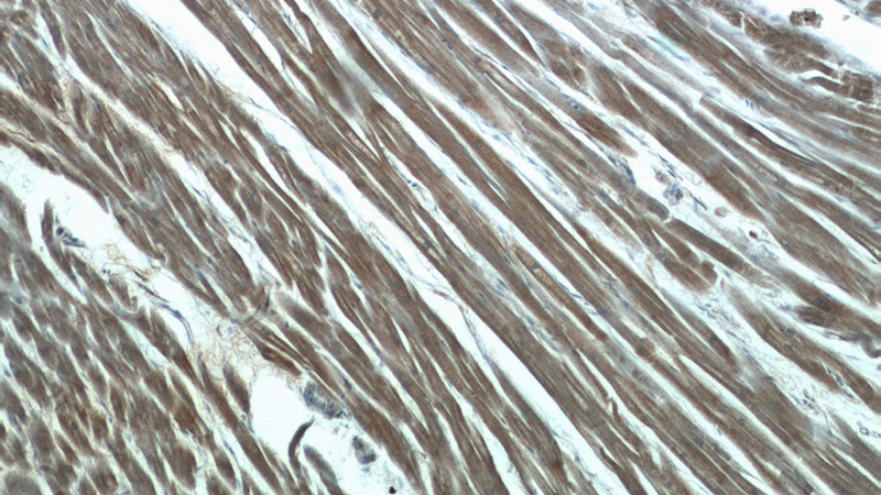 Immunohistochemistry of paraffin-embedded human heart tissue slide using Catalog No:112285(LMOD3 Antibody) at dilution of 1:50 (under 10x lens)