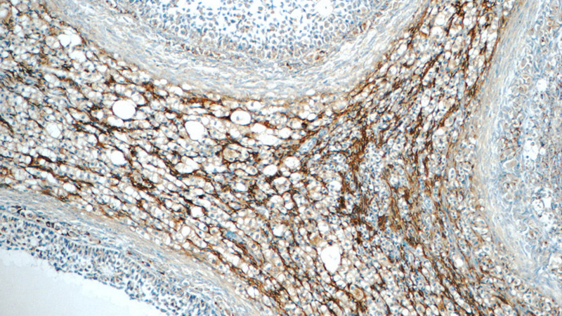Immunohistochemistry of paraffin-embedded human ovary tissue slide using Catalog No:111544(HSD17B11 Antibody) at dilution of 1:50 (under 10x lens)