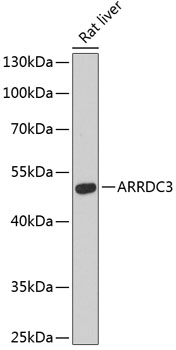 Western blot - ARRDC3 Polyclonal Antibody 